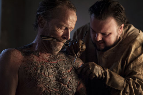 Game of Thrones scene with Jorah being treated by Samwell for greyscale