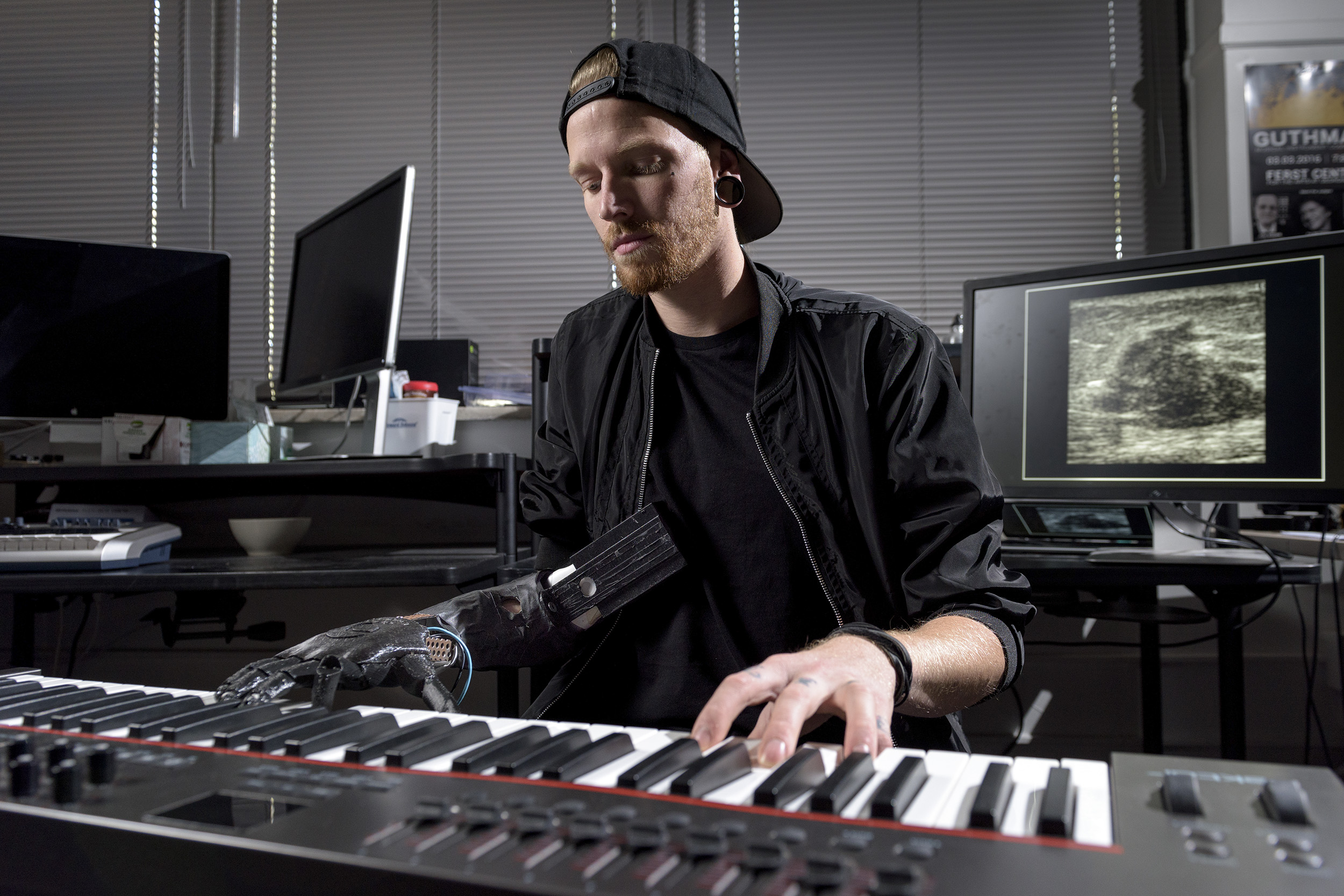 Jason Barnes lost part of his right arm in 2012. He can now play the piano by controlling each of his prosthetic fingers. Jason Barnes lost part of his right arm in 2012. He can now play the piano by controlling each of his prosthetic fingers.