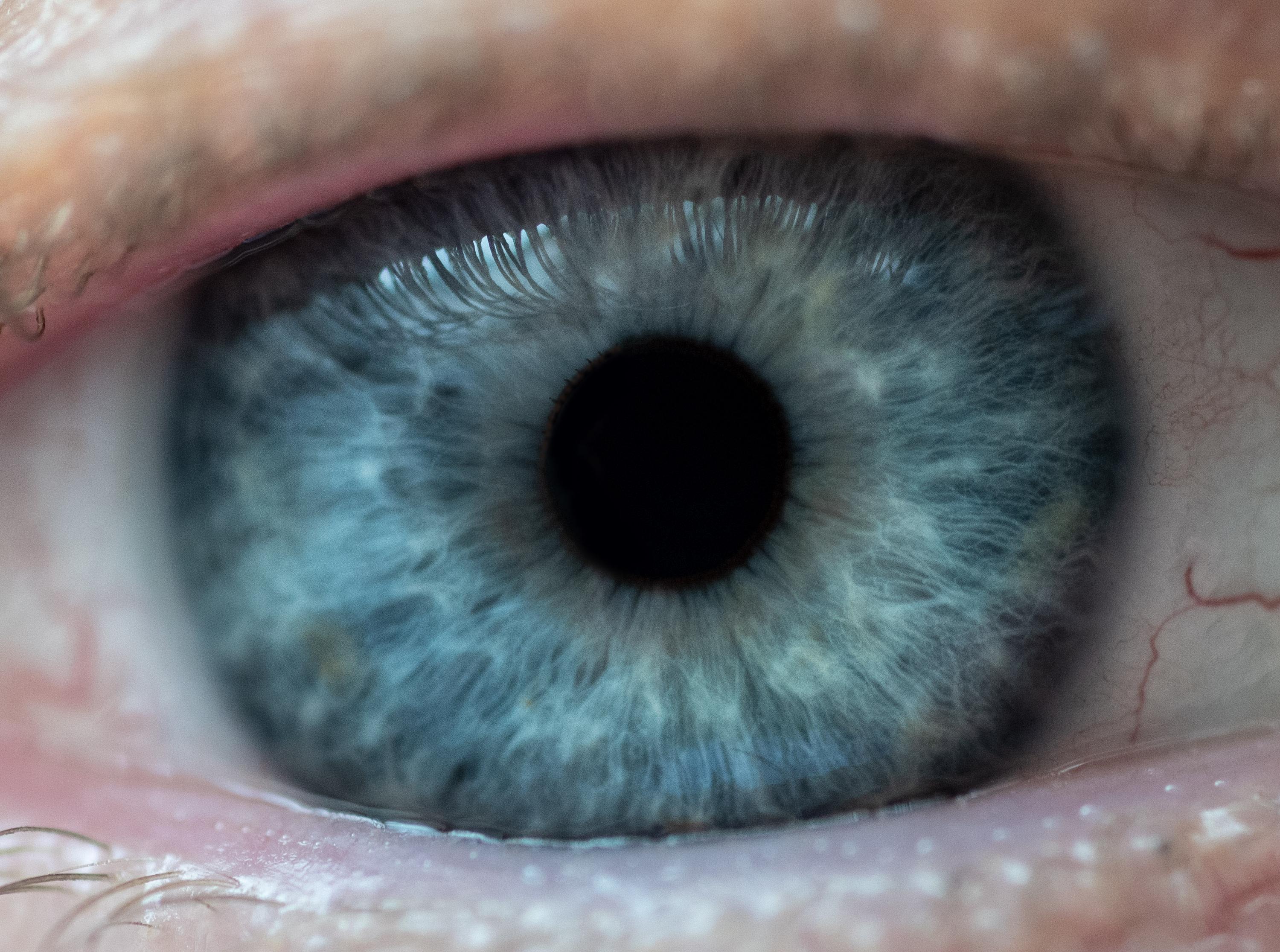 Researchers have developed a potential new treatment for the eye disease glaucoma that could replace daily eye drops and surgery with a twice-a-year injection to control the buildup of pressure in the eye. (Credit: Rob Felt, Georgia Tech) Researchers have developed a potential new treatment for the eye disease glaucoma that could replace daily eye drops and surgery with a twice-a-year injection to control the buildup of pressure in the eye. (Credit: Rob Felt, Georgia Tech)