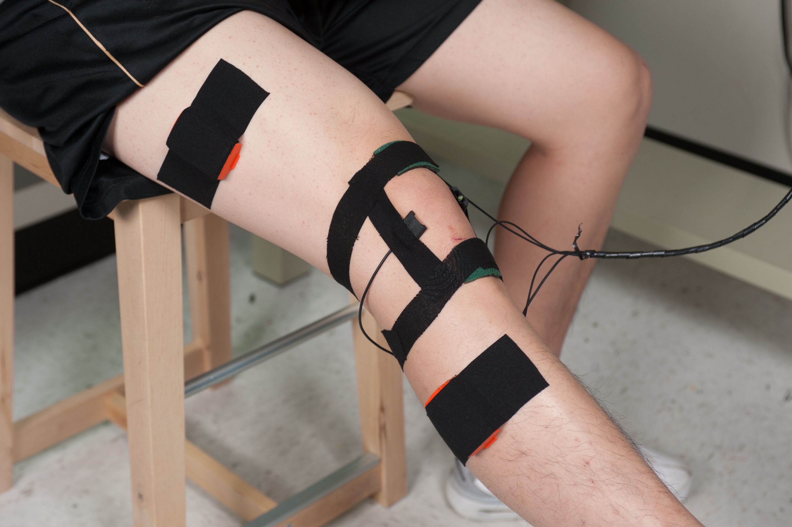 MEMS microphones and piezoelectric strips pick up sounds of a bending and extending knee. Prof. Omer Inan is engineering a device to convert knee joint sounds into a signal he hopes medical researchers will be able to use. MEMS microphones and piezoelectric strips pick up sounds of a bending and extending knee. Prof. Omer Inan is engineering a device to convert knee joint sounds into a signal he hopes medical researchers will be able to use.