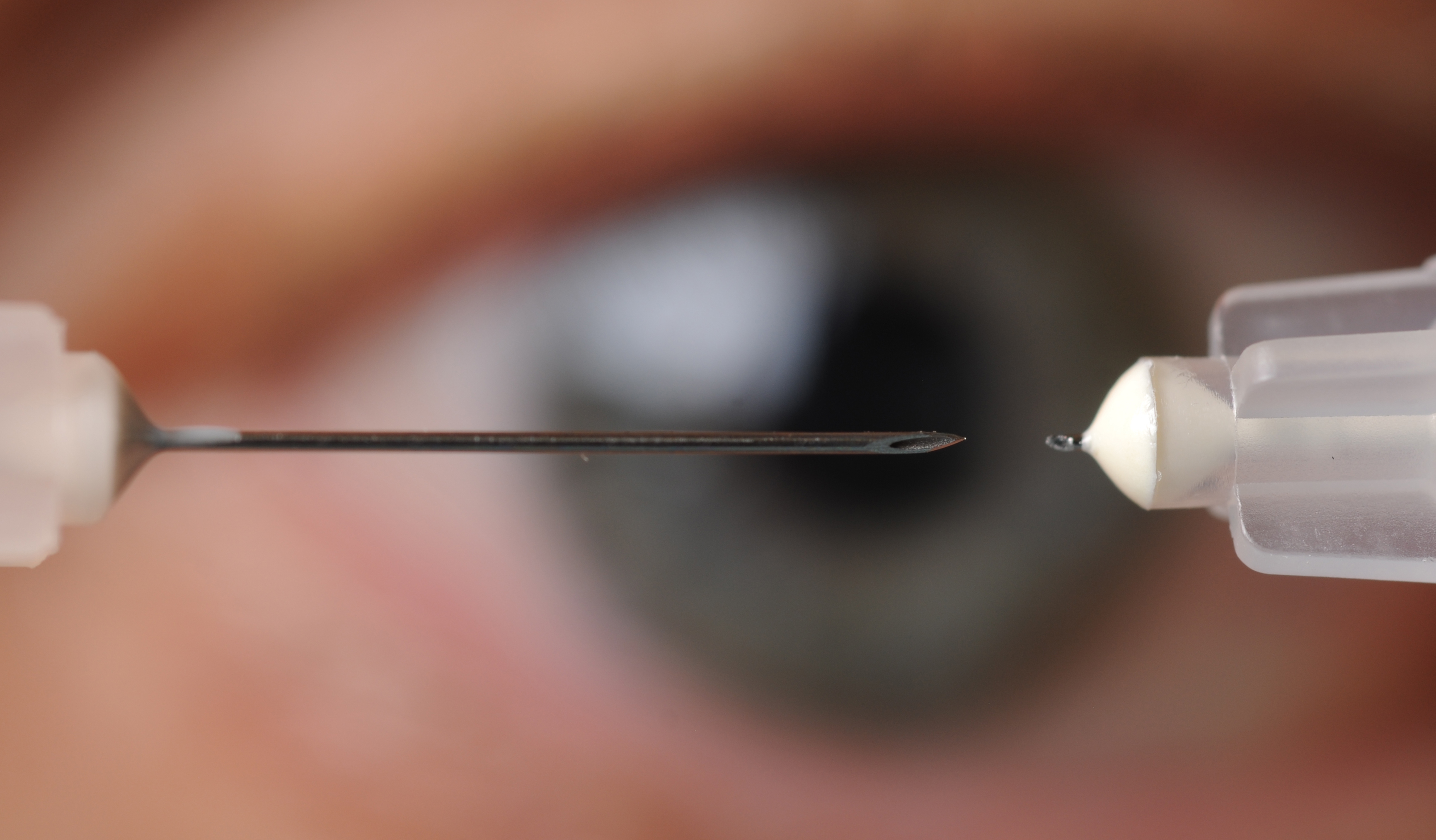 A microneedle used to inject glaucoma medications into the eye is shown next to a conventional hypodermic needle. (Photo credit: Gary Meek). A microneedle used to inject glaucoma medications into the eye is shown next to a conventional hypodermic needle. (Photo credit: Gary Meek).