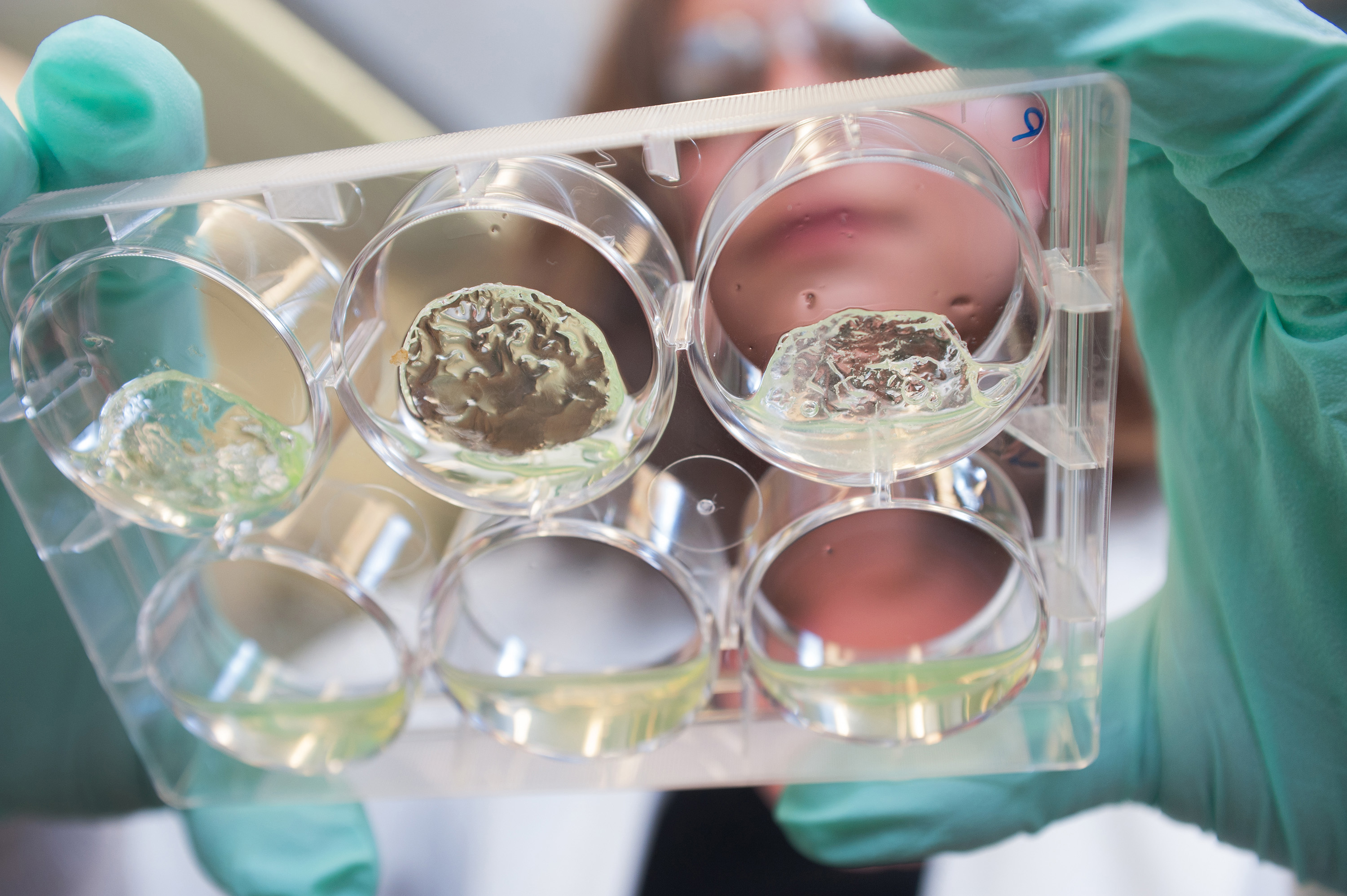 Jessica Weaver, a postdoctoral researcher in Georgia Tech’s Woodruff School of Mechanical Engineering, holds a multiwell plate containing hydrogels with pancreatic islet cells. (Credit: Christopher Moore, Georgia Tech)