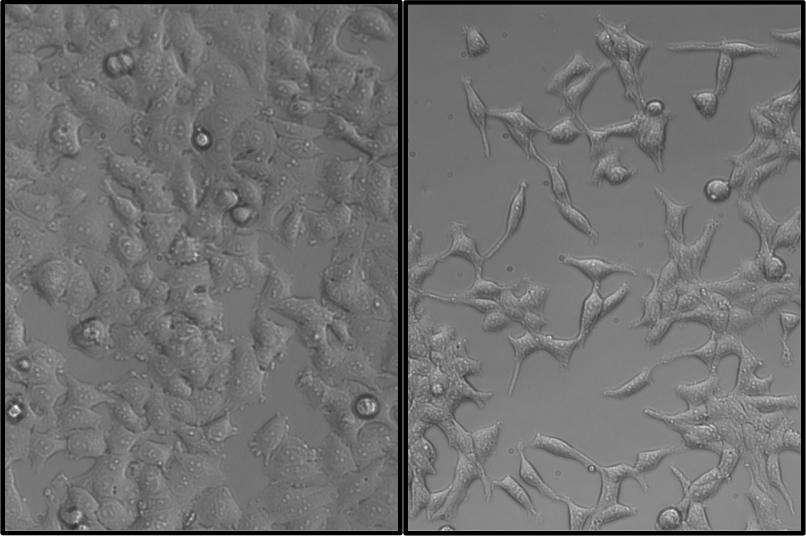 Pictured are MCF-7 human breast cancer cells, stably transformed with SNAIL (right) or an empty vector control (left). Cells expressing SNAIL show an increased mesenchymal phenotype and malignant characteristics. The control cells display a cobblestone morphology, whereas cells overexpressing SNAIL are more elongated. Credit: MgGrail, et al., FASEB 2014.