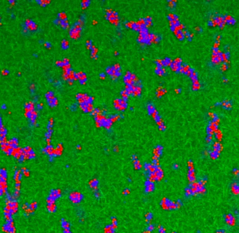 Visualization shows the microgel network architecture in fibrin–microgel composite materials. Confocal microscopy images of fluorescently labeled microgels (shown in blue and red) and fibrin (shown in green) demonstrate that at a critical volume fraction, the microgels form an interconnected tunnel network within the fibrous fibrin matrix. Microgels are tightly packed and only slightly jiggle around within the microgel domains. (Credit: Alison Douglas) Visualization shows the microgel network architecture in fibrin–microgel composite materials. Confocal microscopy images of fluorescently labeled microgels (shown in blue and red) and fibrin (shown in green) demonstrate that at a critical volume fraction, the microgels form an interconnected tunnel network within the fibrous fibrin matrix. Microgels are tightly packed and only slightly jiggle around within the microgel domains. (Credit: Alison Douglas)