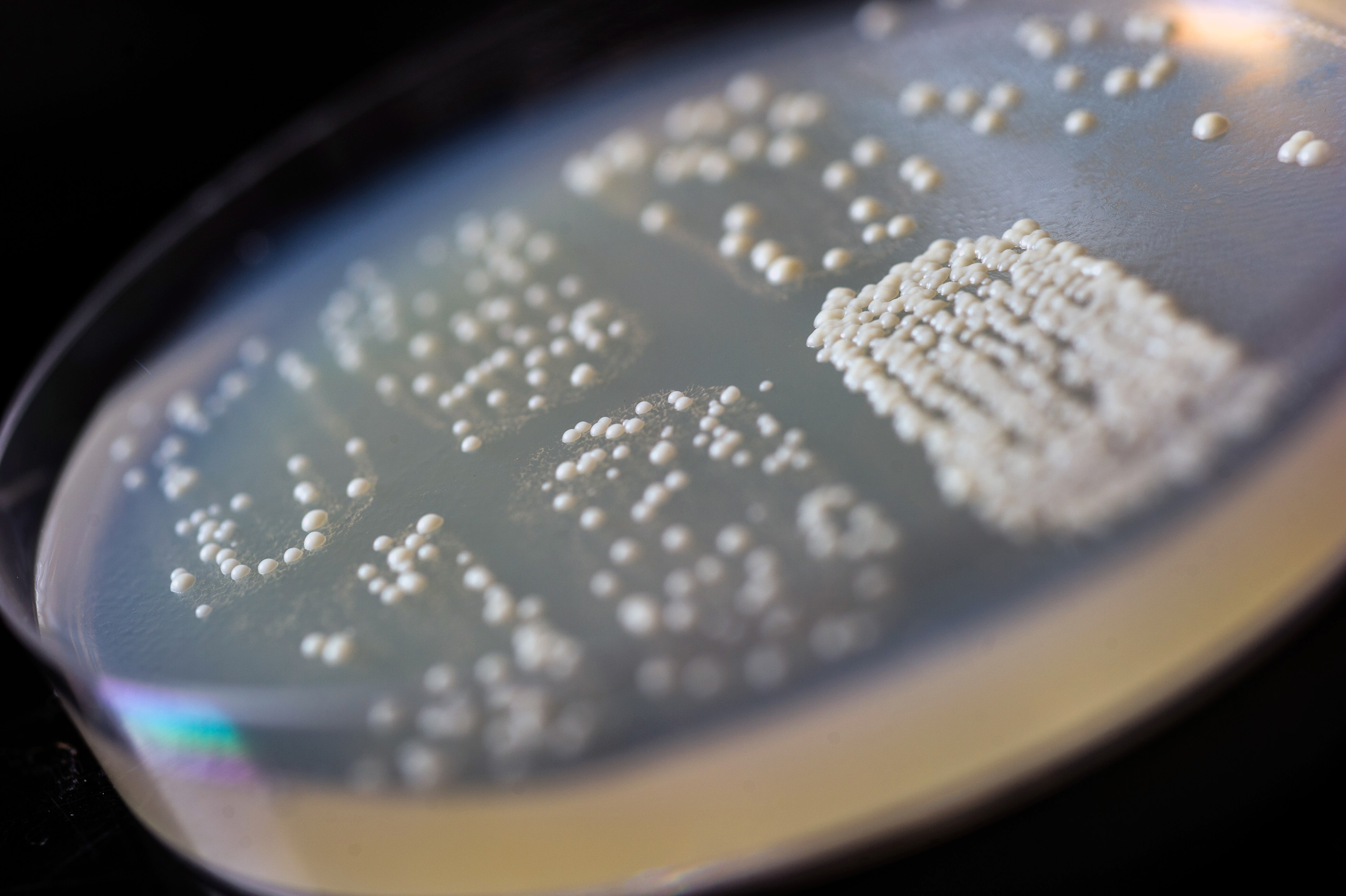 The growth of the budding yeast colonies in the four patches at the bottom of the Petri dish indicates that DNA has been repaired by using transcript RNA from within the cells. (Georgia Tech Photo: Rob Felt) The growth of the budding yeast colonies in the four patches at the bottom of the Petri dish indicates that DNA has been repaired by using transcript RNA from within the cells. (Georgia Tech Photo: Rob Felt)