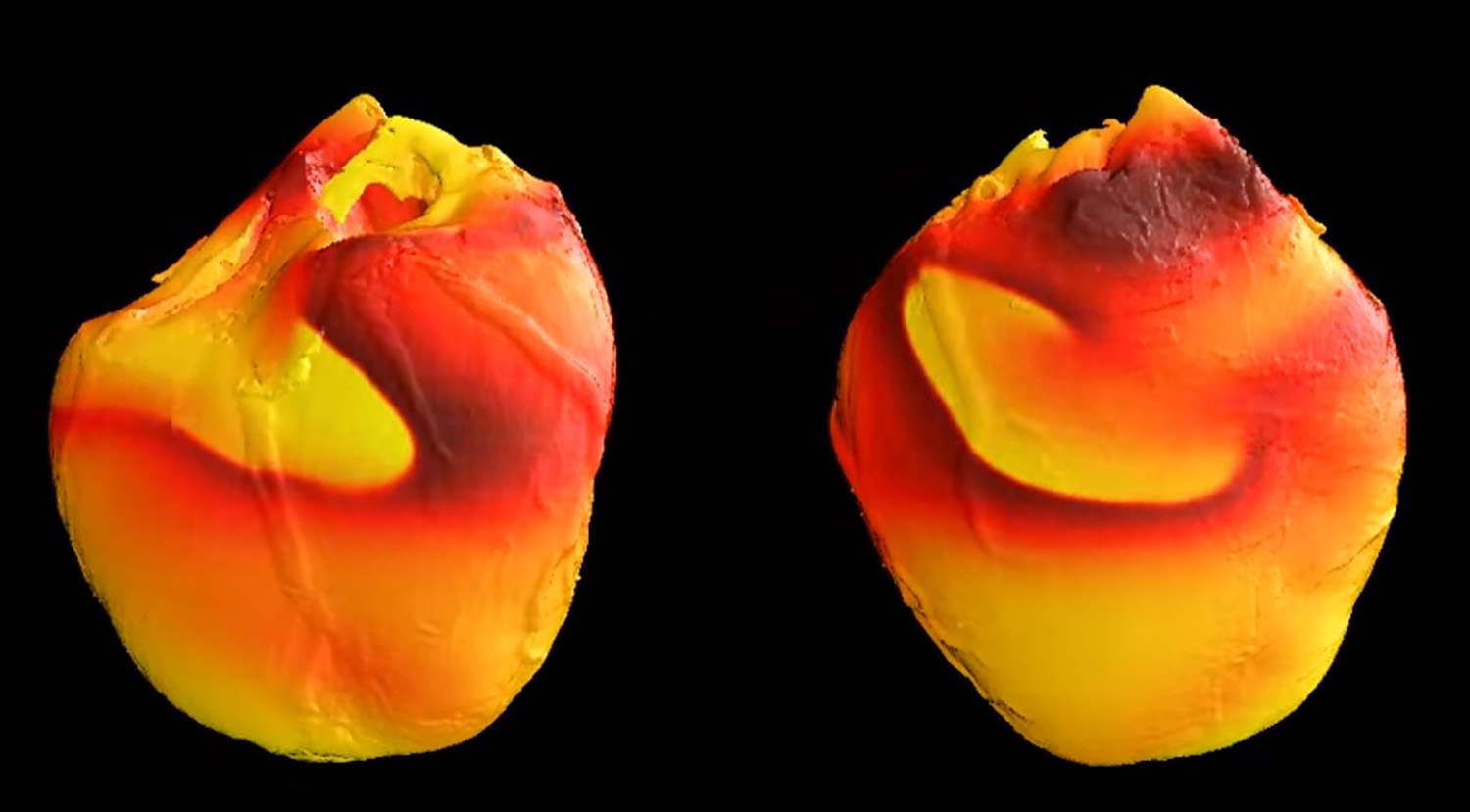 Image produced by Richard Gray and Pras Pathmanathan at the FDA shows simulated fibrillation in a rabbit heart. (Credit: FDA)
