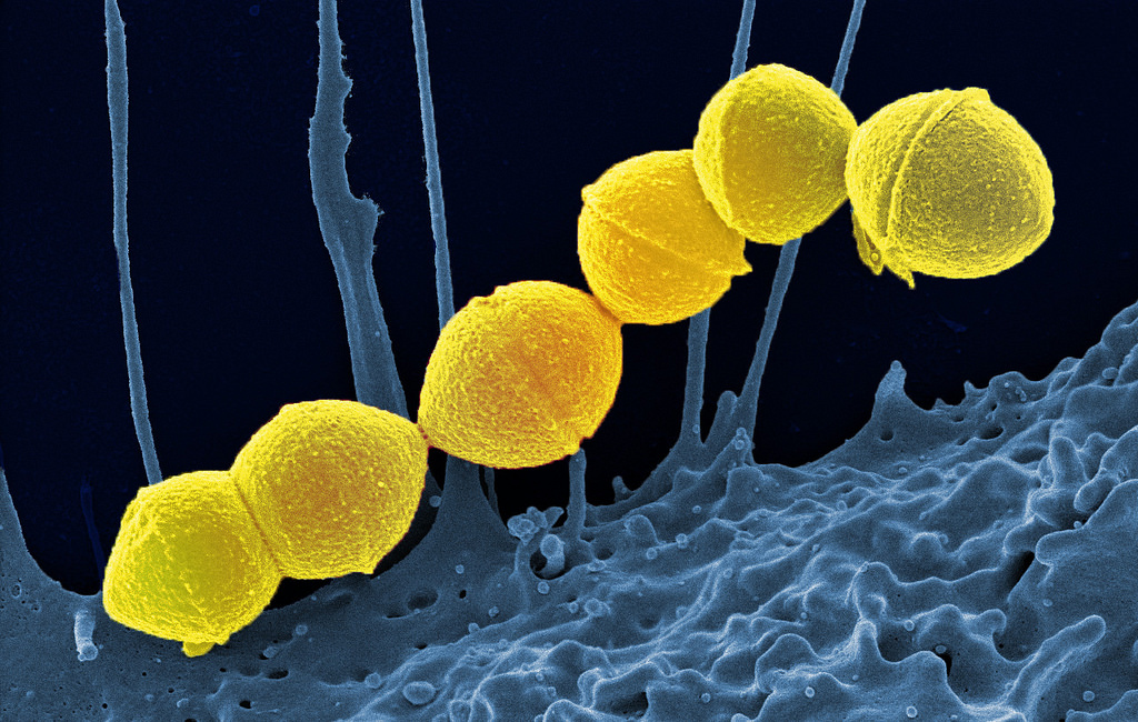 Group A Streptococci, colored yellow, are the most common culprits in bacterial upper respiratory infections. Credit: National Institute of Allergy and Infectious Diseases of the NIH