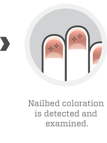 Icon of a closeup of fingernails with crosshair markers where color is being examined