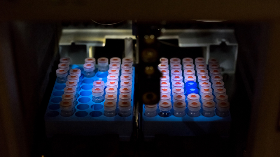 ovarian cancer tests