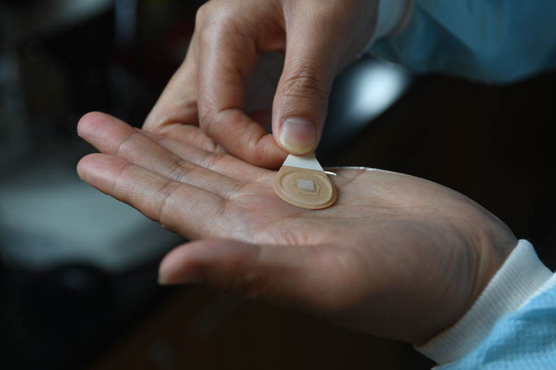 microneedle patch