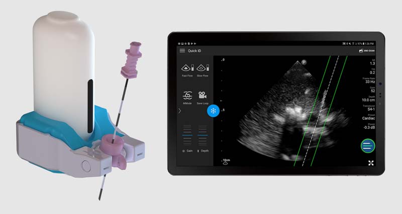 Composite image of CAD rendering of device plus a sonogram of how it enters the body