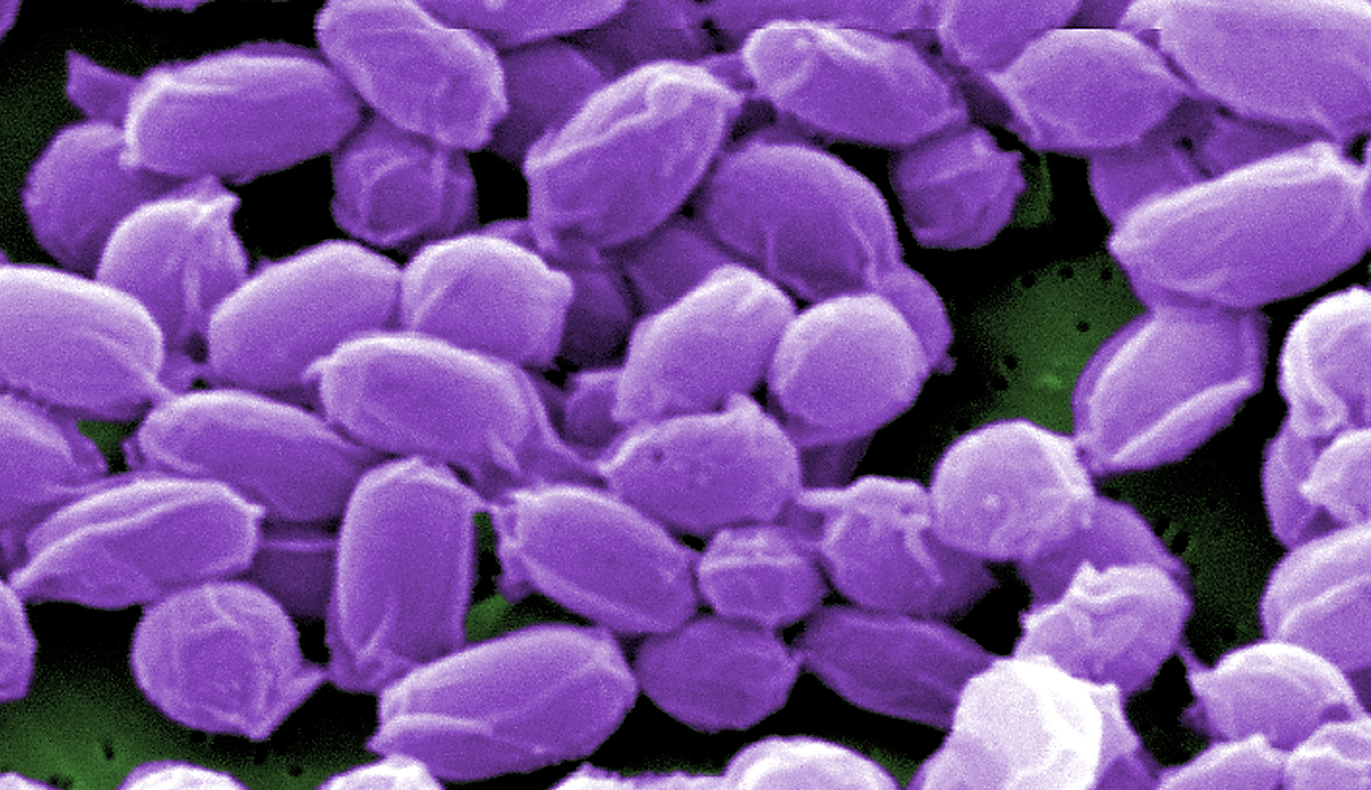 Under high magnification, this digitally-colorized scanning electron microscope image depicts endospores from Bacillus anthracis bacteria. These endospores can live for many years, which enables these bacteria to survive in a dormant state. (CDC image) Under high magnification, this digitally-colorized scanning electron microscope image depicts endospores from Bacillus anthracis bacteria. These endospores can live for many years, which enables these bacteria to survive in a dormant state. (CDC image)