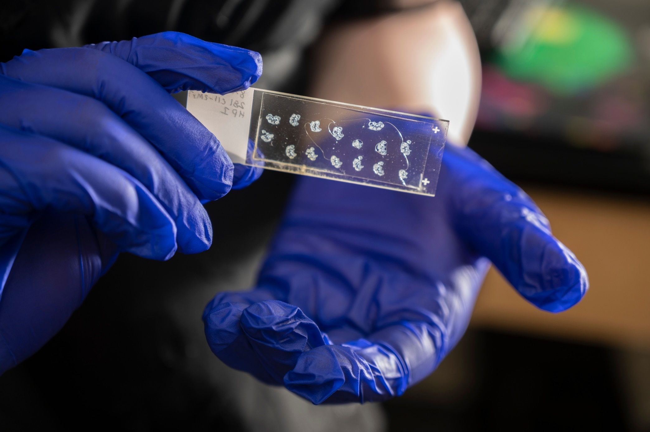 These mouse hindpaw sections allow Georgia Tech researchers to visualize skin nerves. (Photo Credit: Christopher Moore, Georgia Tech)