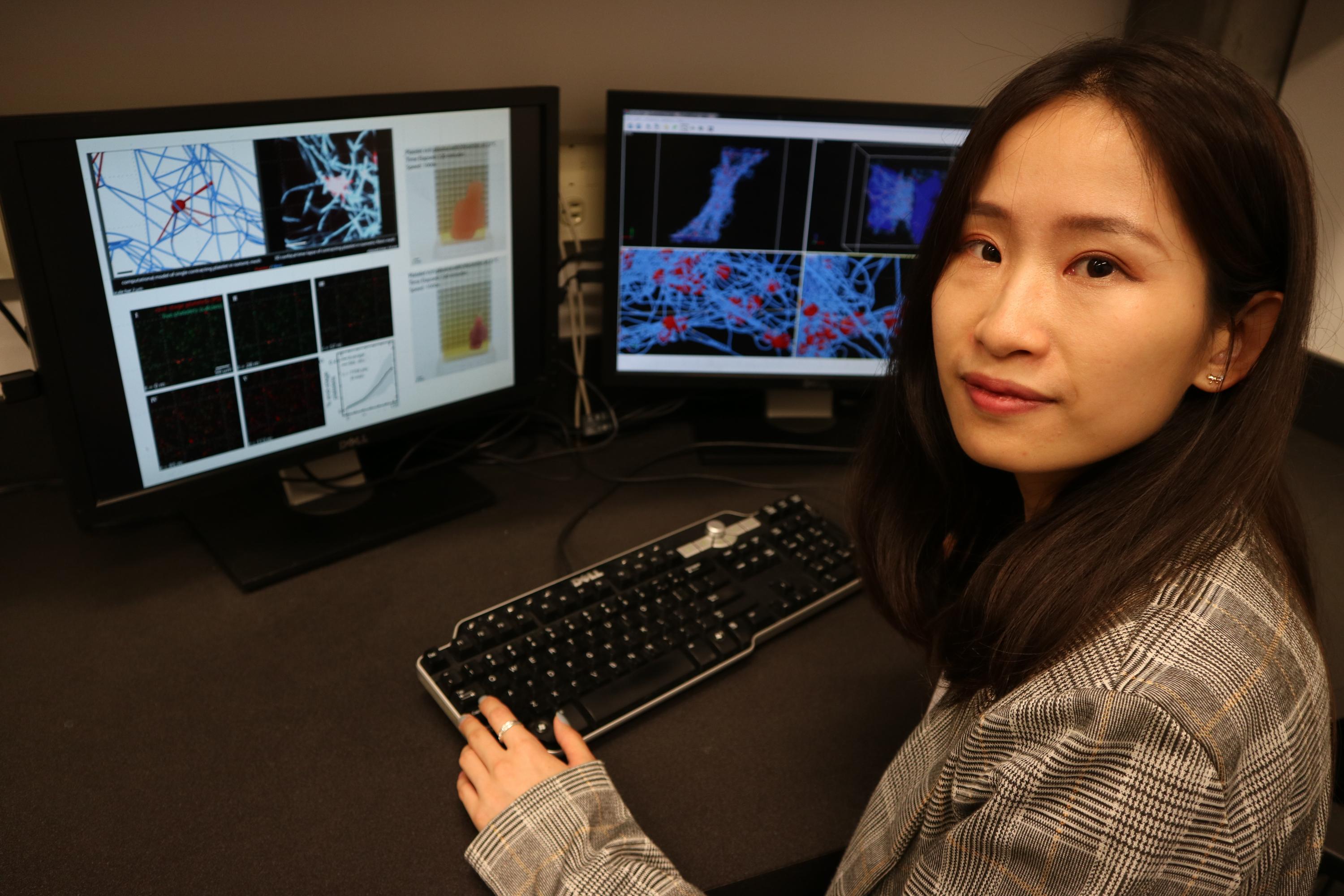 First author Yueyi Sun inside Georgia Tech’s Complex Fluids Modeling and Simulation Lab, where she compares the experimental and simulated platelet-driven fibrin clot contraction process. (Photo Credit: Alexander Alexeev, Georgia Tech)