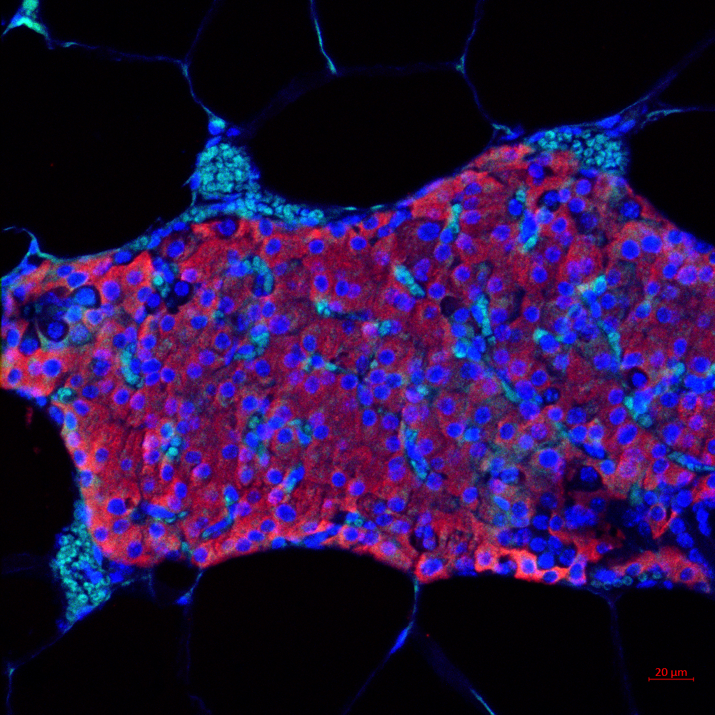 Transplanted pancreatic islet cells in which insulin is shown in red, the cell nucleus in blue, and the blood vessels in aqua. (Credit: Maria Coronel, Georgia Tech) Transplanted pancreatic islet cells in which insulin is shown in red, the cell nucleus in blue, and the blood vessels in aqua. (Credit: Maria Coronel, Georgia Tech)