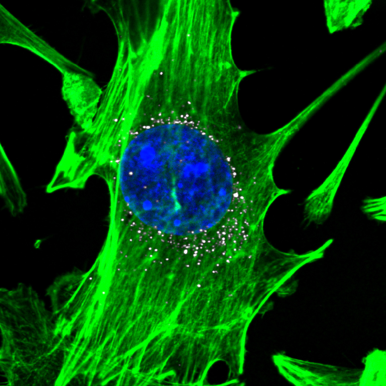 Cells, stained in green with blue nuclei, are targeted by nanoparticles carrying DNA barcodes (white). The nanoparticles efficiently delivery their DNA payload into the cells. (Image courtesy of Daryll A. Vanover, Kalina Paunovska, and Cory Sago at Georgia Tech). Cells, stained in green with blue nuclei, are targeted by nanoparticles carrying DNA barcodes (white). The nanoparticles efficiently delivery their DNA payload into the cells. (Image courtesy of Daryll A. Vanover, Kalina Paunovska, and Cory Sago at Georgia Tech).