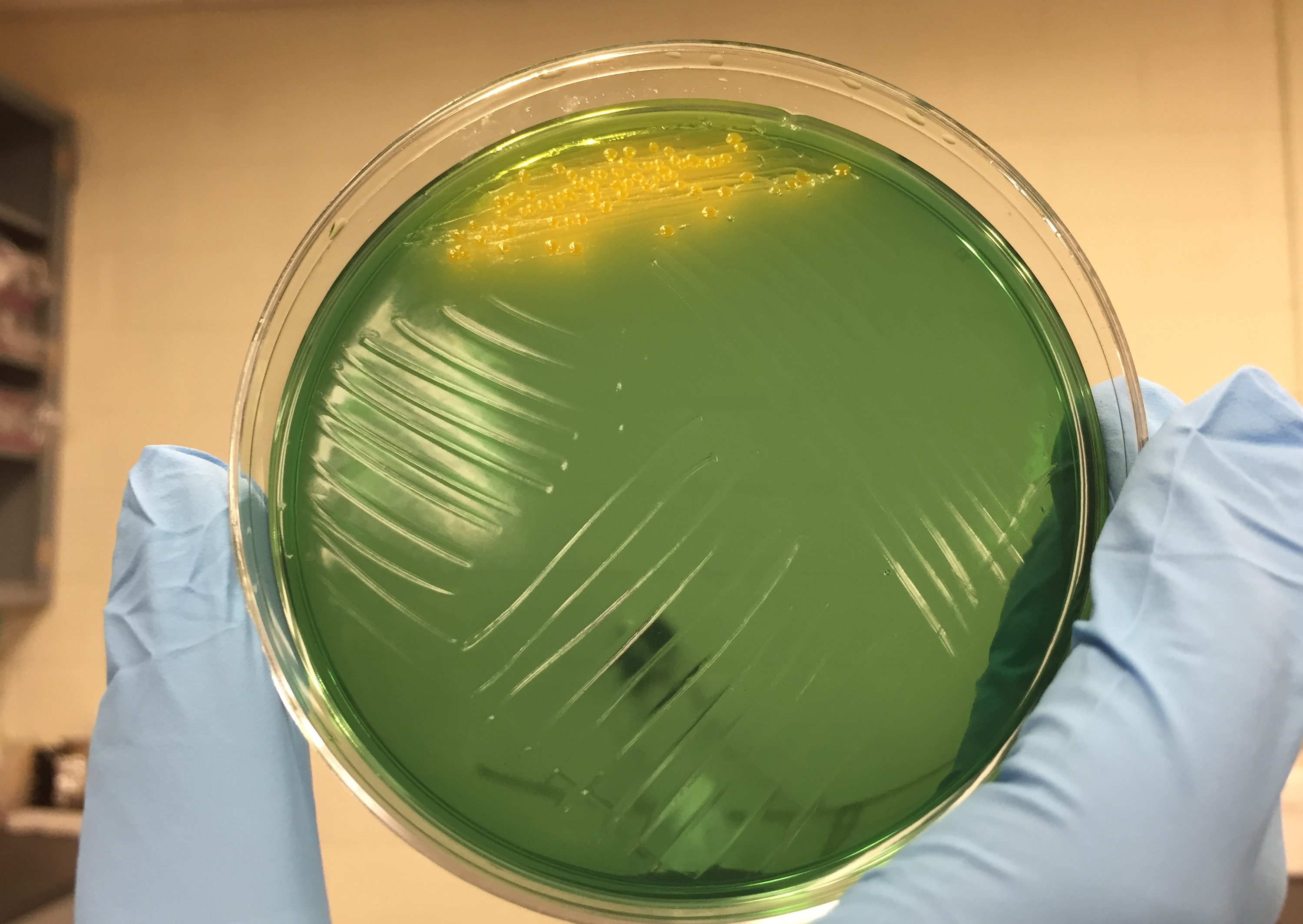 Image shows cholera colonies (yellow) growing on an agar plate. Growth of the bacterium was part of research into the diversity and resourcefulness of the bacterium. (Credit: John Toon, Georgia Tech)