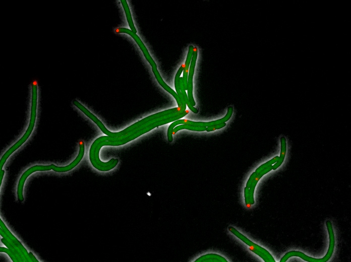 Image shows E. coli cells under the stress of DHFR-targeting antibiotic trimethoprim in a 2015 study done prior to the research reported in this paper. The green color comes from GFP protein fused to DHFR and shows the uniform distribution of DHFR. The red color shows location of inclusion bodies of aggregated proteins in the cell. (Courtesy of Eugene Shakhnovich)