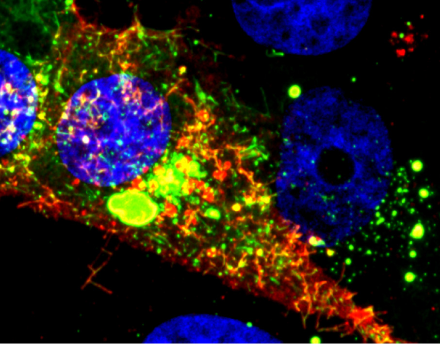 This microscope image shows a cell infected with RSV. The RNA tagged by the probe is shown in red, while the nucleoprotein is green. (Image courtesy of Eric Alonas and Philip Santangelo) This microscope image shows a cell infected with RSV. The RNA tagged by the probe is shown in red, while the nucleoprotein is green. (Image courtesy of Eric Alonas and Philip Santangelo)