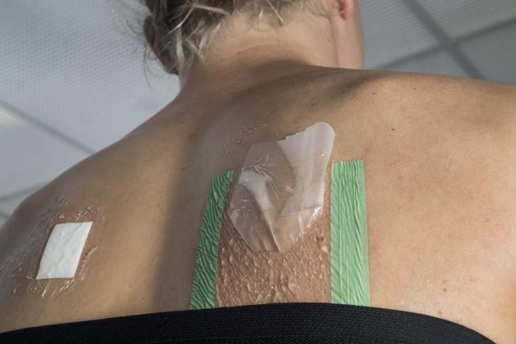 A little bag collects sweat from the backs of subjects who participate in studies involving fluid loss and its possible consequences. This photo is not connected with a particular study. Credit: Georgia Tech / Christopher Moore